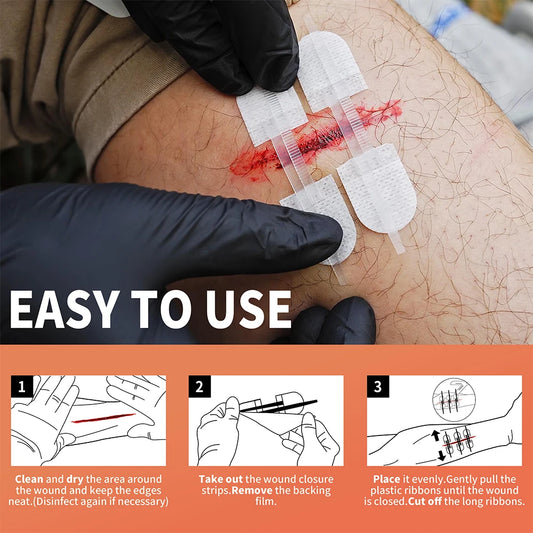 Zip stitch 6pcs wound closure strips adjustable adhesive laceration device ivory - product image